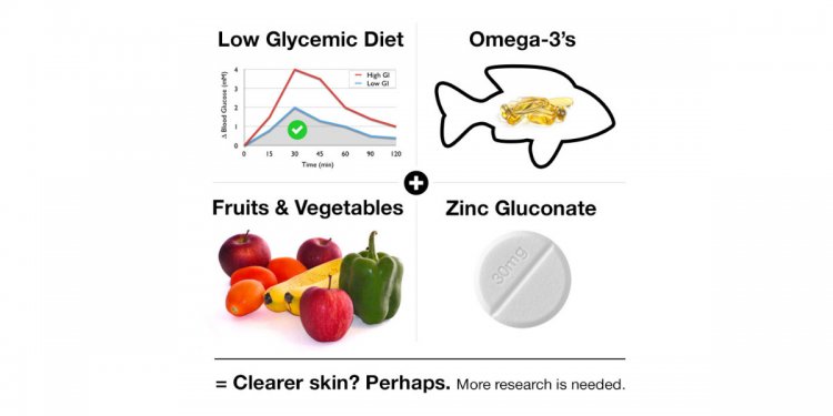 Diet and Acne: The Full Story